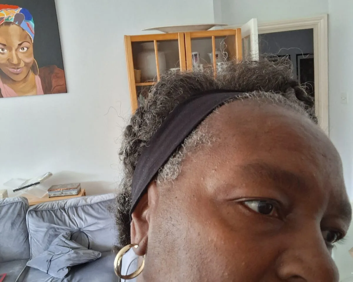 Skin after seborrheic keratosis treatment