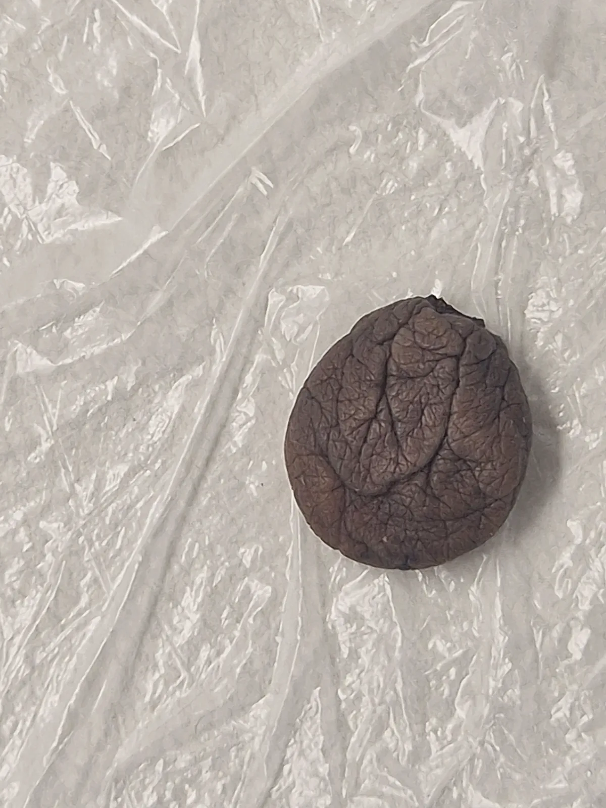 Removed skin tag immediately after treatment